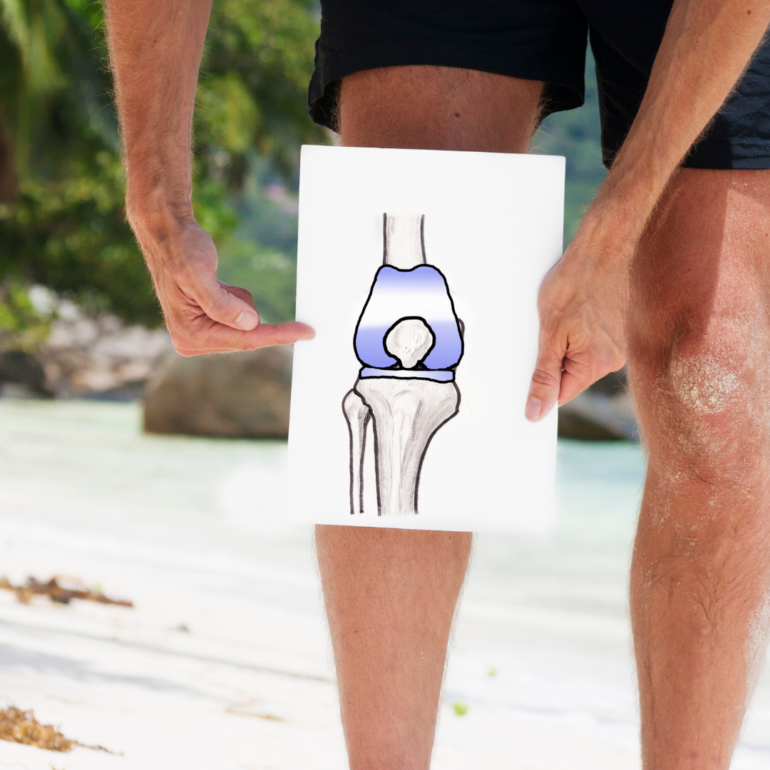 important-exercises-to-do-before-a-knee-replacement-the-senior